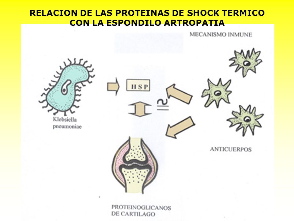 RELACION DE LAS PROTEINAS DE SHOCK TERMICO CON LA ESPONDILO ARTROPATIA