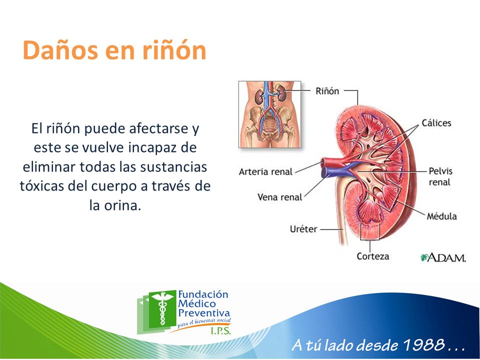 Daños en riñón El riñón puede afectarse y este se vuelve incapaz de eliminar todas las sustancias tóxicas del cuerpo a través de la orina.