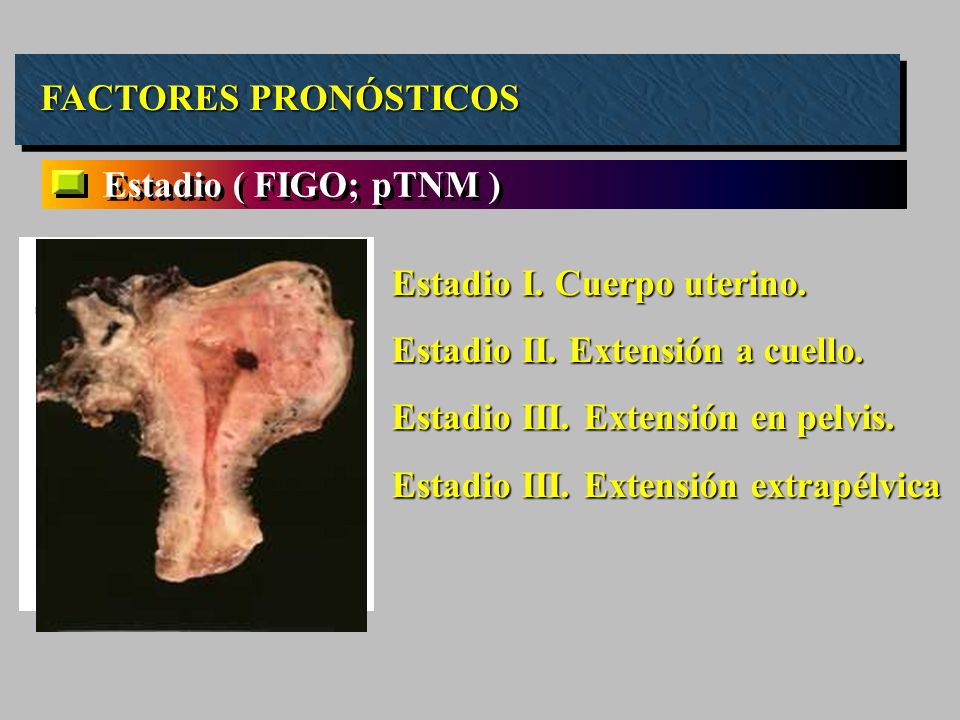 FACTORES PRONÓSTICOS Estadio ( FIGO; pTNM ) Estadio I. Cuerpo uterino. Estadio II. Extensión a cuello.