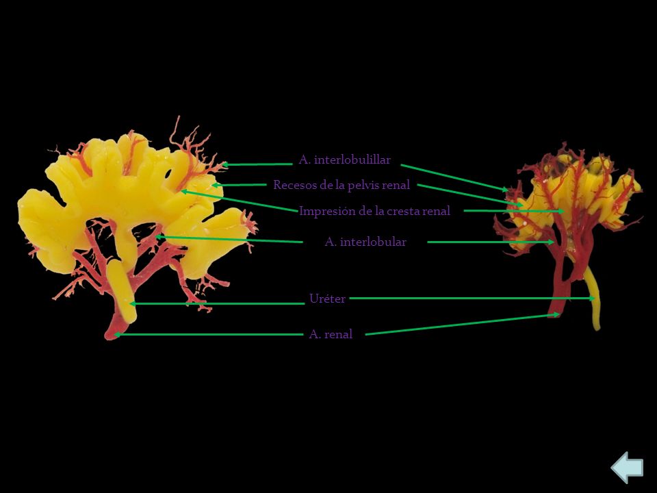 A. interlobulillar Recesos de la pelvis renal. Impresión de la cresta renal. A. interlobular. Uréter.