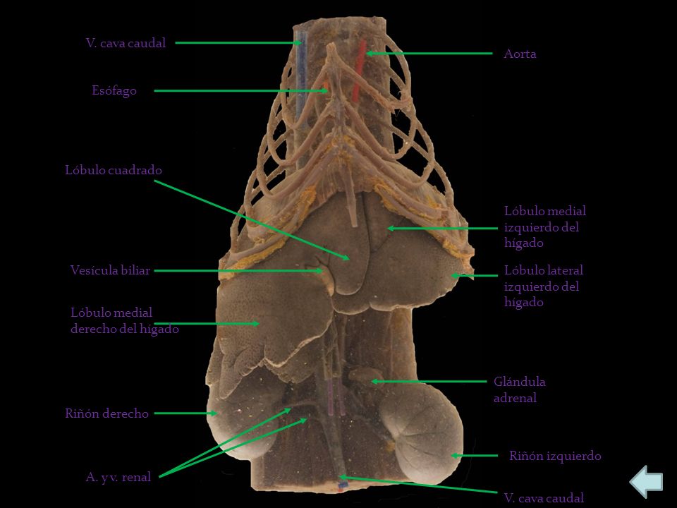 V. cava caudal Aorta. Esófago. Lóbulo cuadrado. Lóbulo medial izquierdo del hígado. Vesícula biliar.