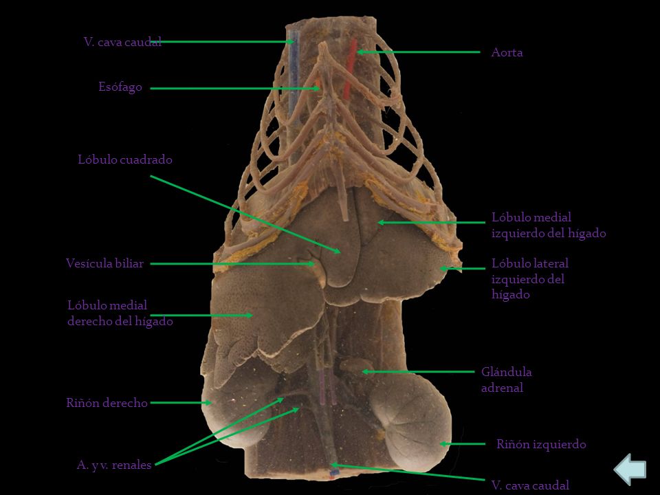 V. cava caudal Aorta. Esófago. Lóbulo cuadrado. Lóbulo medial izquierdo del hígado. Vesícula biliar.