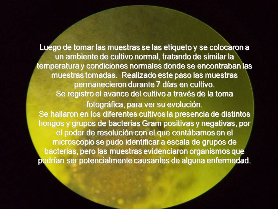 Luego de tomar las muestras se las etiqueto y se colocaron a un ambiente de cultivo normal, tratando de similar la temperatura y condiciones normales donde se encontraban las muestras tomadas. Realizado este paso las muestras permanecieron durante 7 días en cultivo.