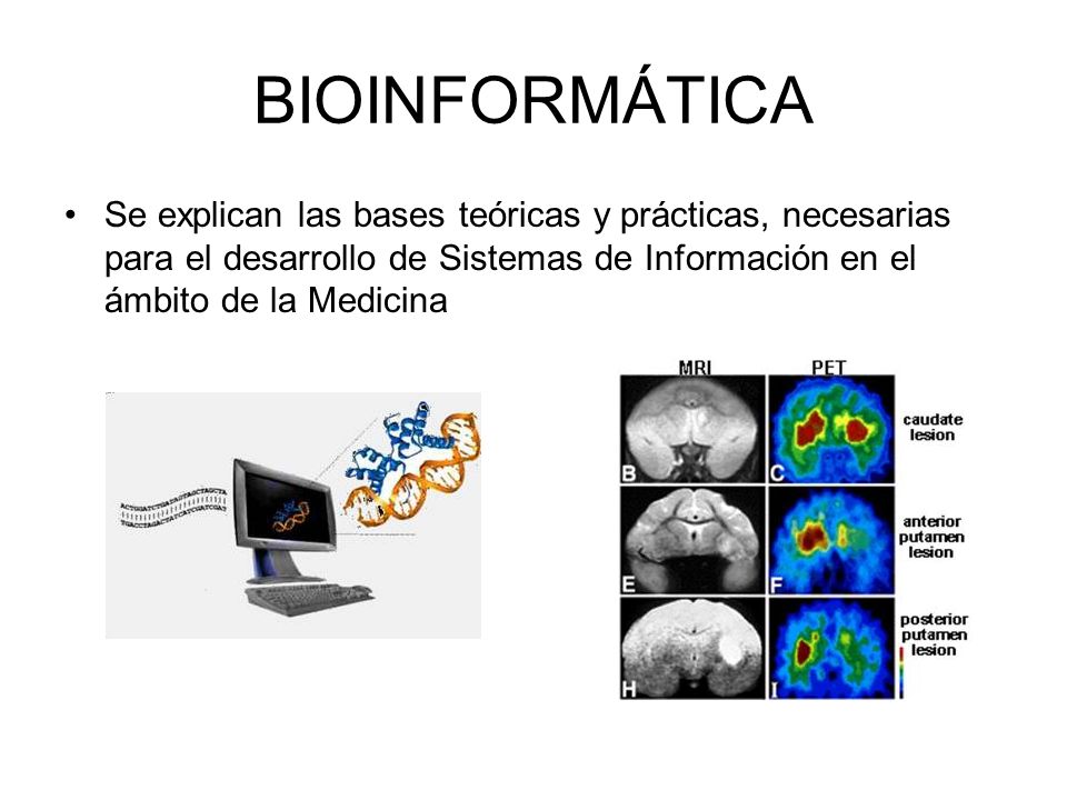 BIOINFORMÁTICA Se explican las bases teóricas y prácticas, necesarias para el desarrollo de Sistemas de Información en el ámbito de la Medicina.