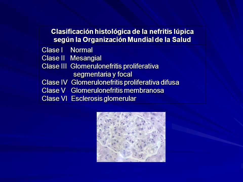 Clasificación histológica de la nefritis lúpica según la Organización Mundial de la Salud