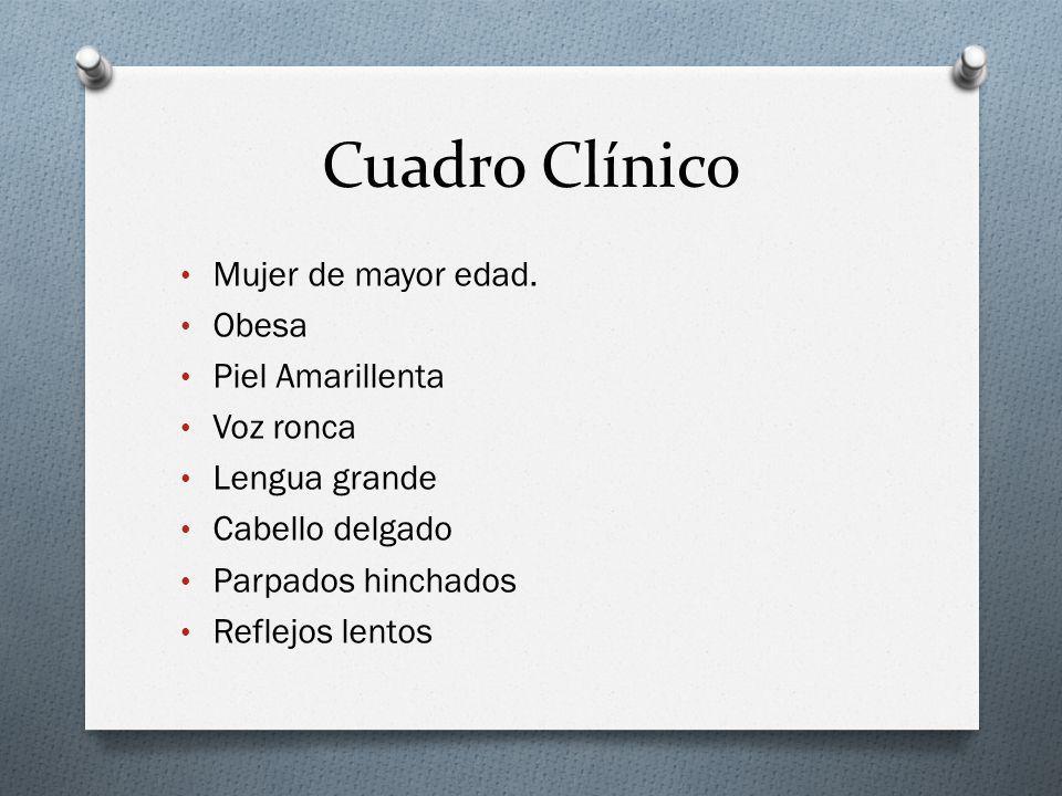 Cuadro Clínico Mujer de mayor edad. Obesa Piel Amarillenta Voz ronca