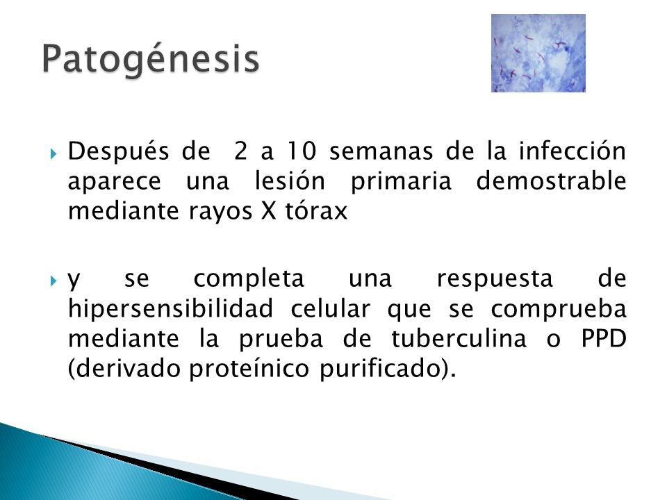 Patogénesis Después de 2 a 10 semanas de la infección aparece una lesión primaria demostrable mediante rayos X tórax.