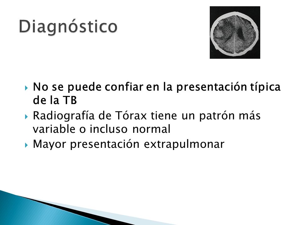 Diagnóstico No se puede confiar en la presentación típica de la TB