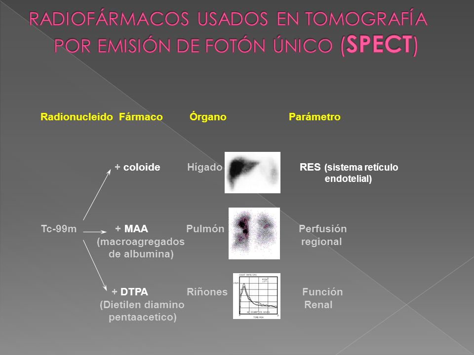 RADIOFÁRMACOS USADOS EN TOMOGRAFÍA POR EMISIÓN DE FOTÓN ÚNICO (SPECT)