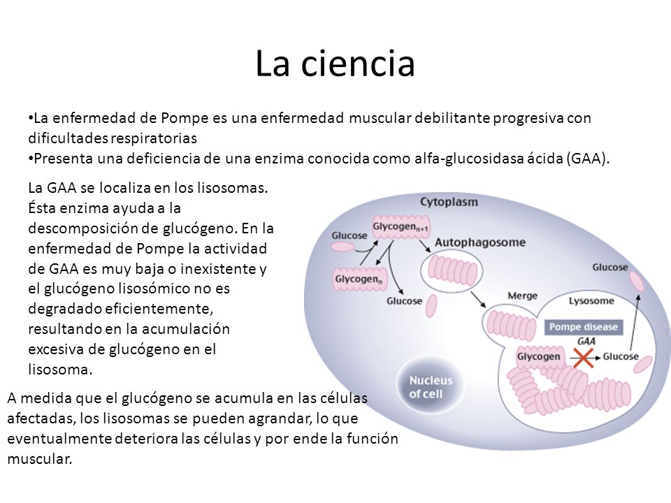 La ciencia La enfermedad de Pompe es una enfermedad muscular debilitante progresiva con. dificultades respiratorias.