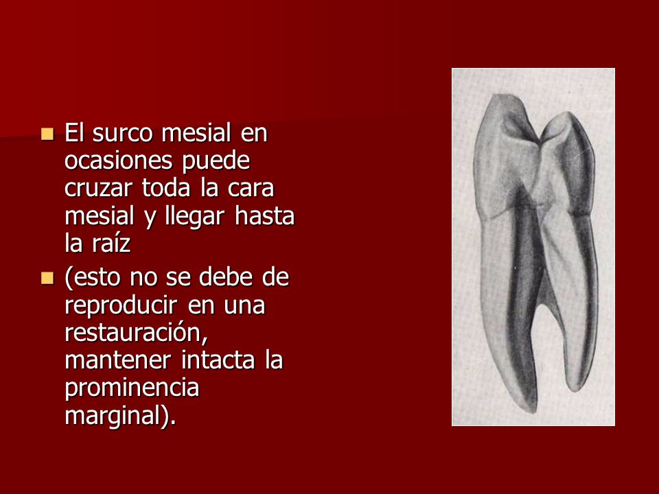 El surco mesial en ocasiones puede cruzar toda la cara mesial y llegar hasta la raíz