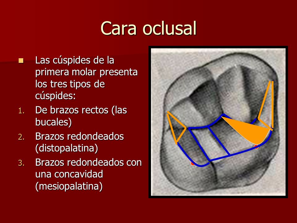 Cara oclusal Las cúspides de la primera molar presenta los tres tipos de cúspides: De brazos rectos (las bucales)