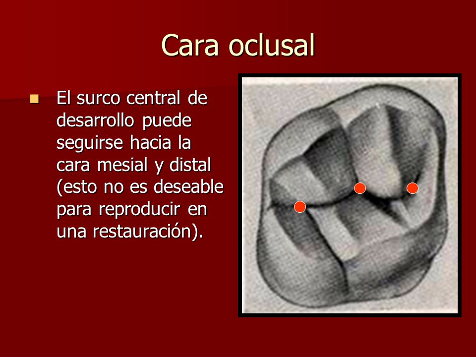 Cara oclusal El surco central de desarrollo puede seguirse hacia la cara mesial y distal (esto no es deseable para reproducir en una restauración).