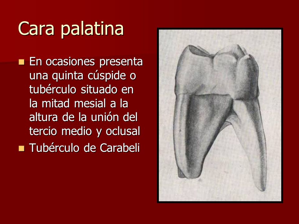 Cara palatina En ocasiones presenta una quinta cúspide o tubérculo situado en la mitad mesial a la altura de la unión del tercio medio y oclusal.