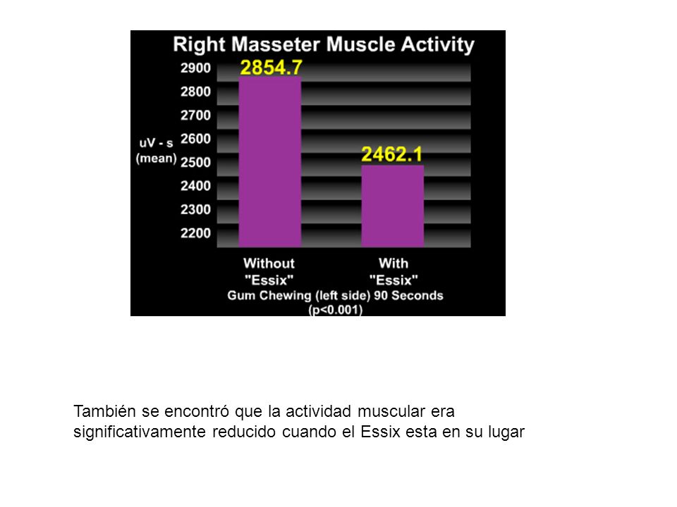 También se encontró que la actividad muscular era significativamente reducido cuando el Essix esta en su lugar
