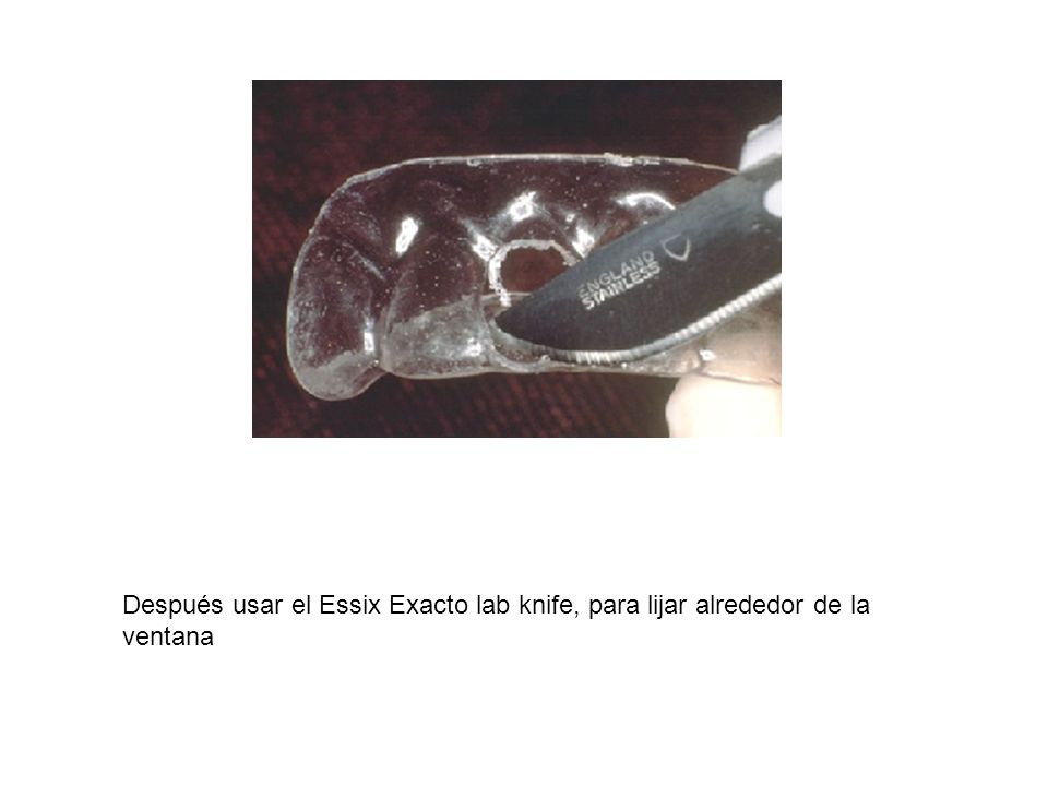 Después usar el Essix Exacto lab knife, para lijar alrededor de la ventana