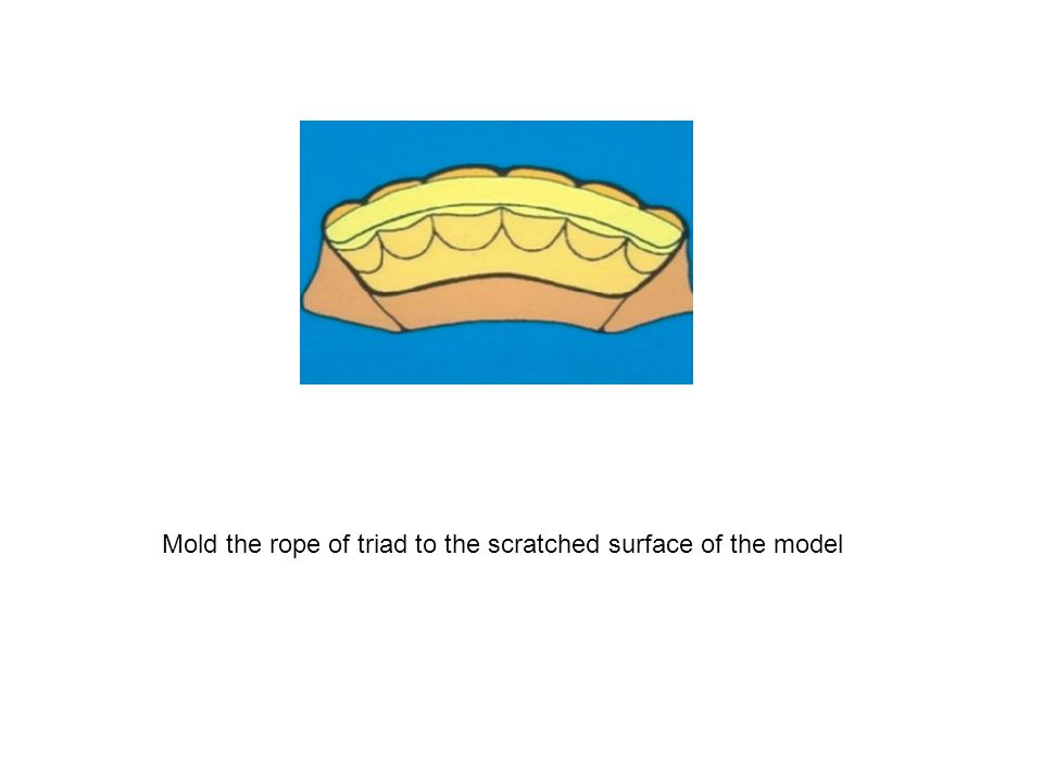 Mold the rope of triad to the scratched surface of the model
