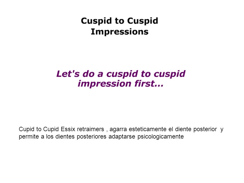 Cupid to Cupid Essix retraimers , agarra esteticamente el diente posterior y permite a los dientes posteriores adaptarse psicologicamente
