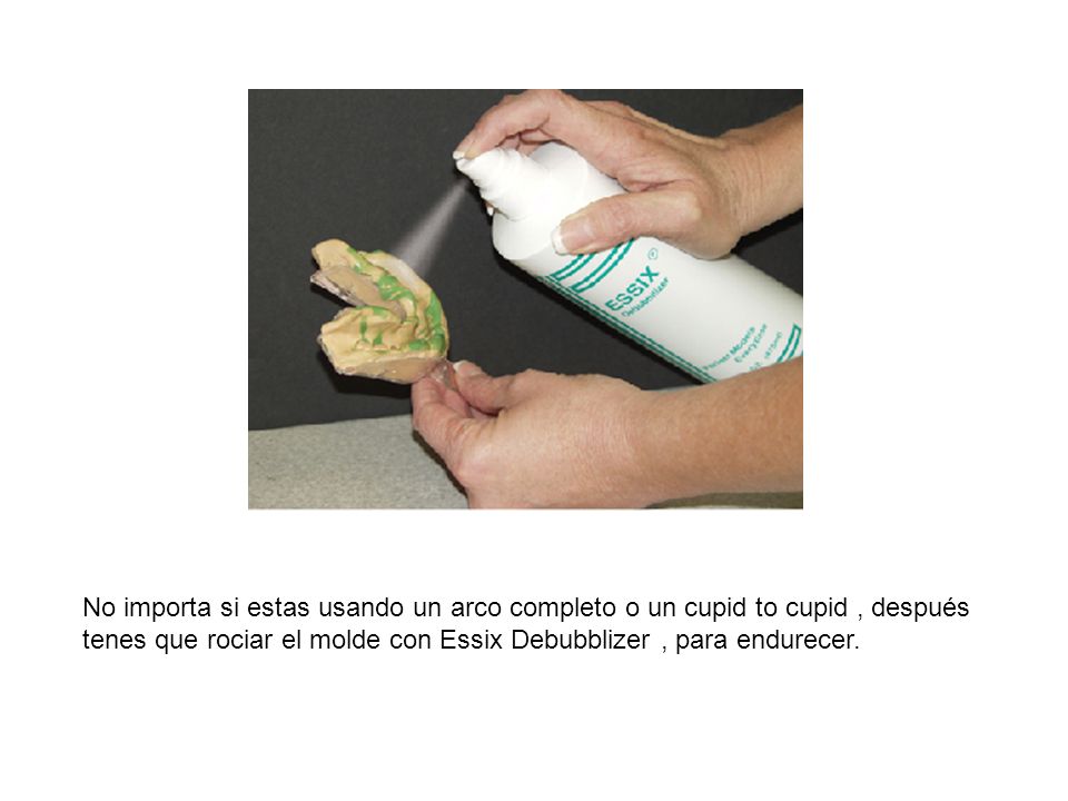 No importa si estas usando un arco completo o un cupid to cupid , después tenes que rociar el molde con Essix Debubblizer , para endurecer.