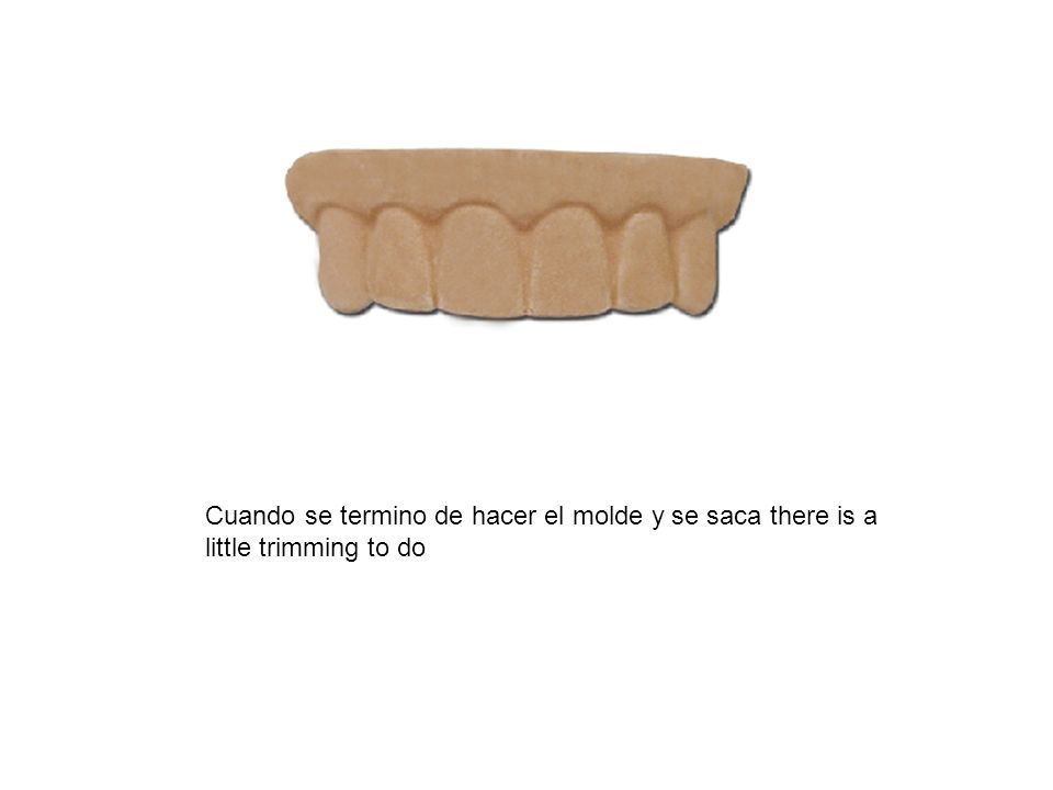 Cuando se termino de hacer el molde y se saca there is a little trimming to do
