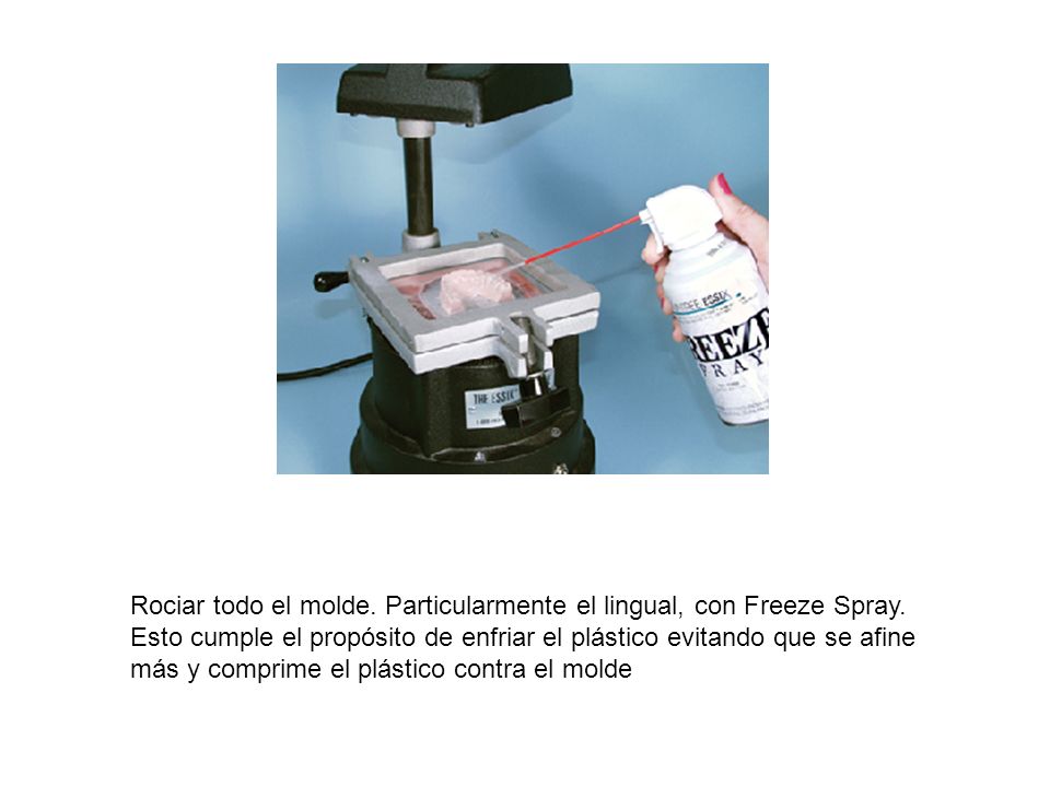 Rociar todo el molde. Particularmente el lingual, con Freeze Spray