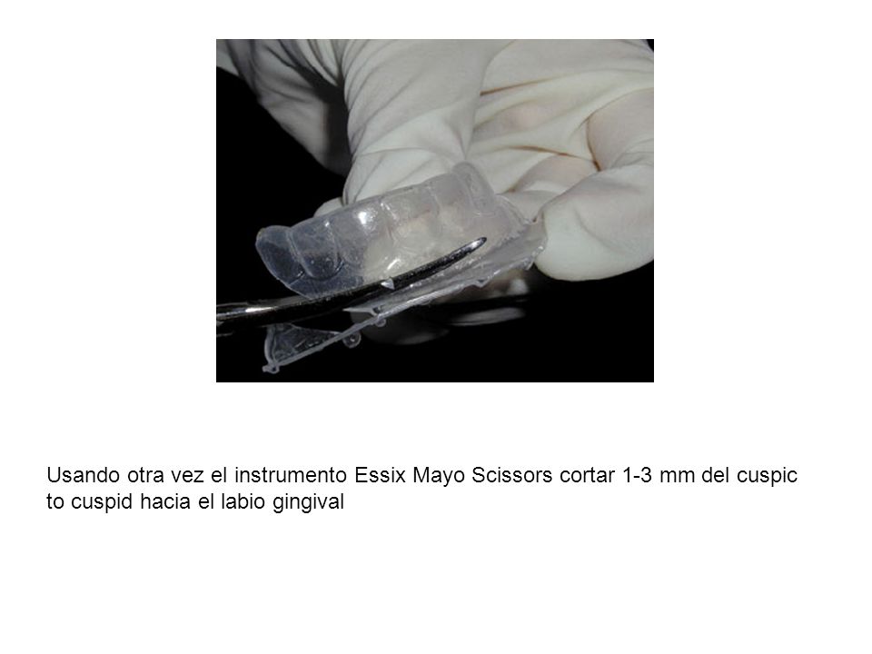 Usando otra vez el instrumento Essix Mayo Scissors cortar 1-3 mm del cuspic to cuspid hacia el labio gingival