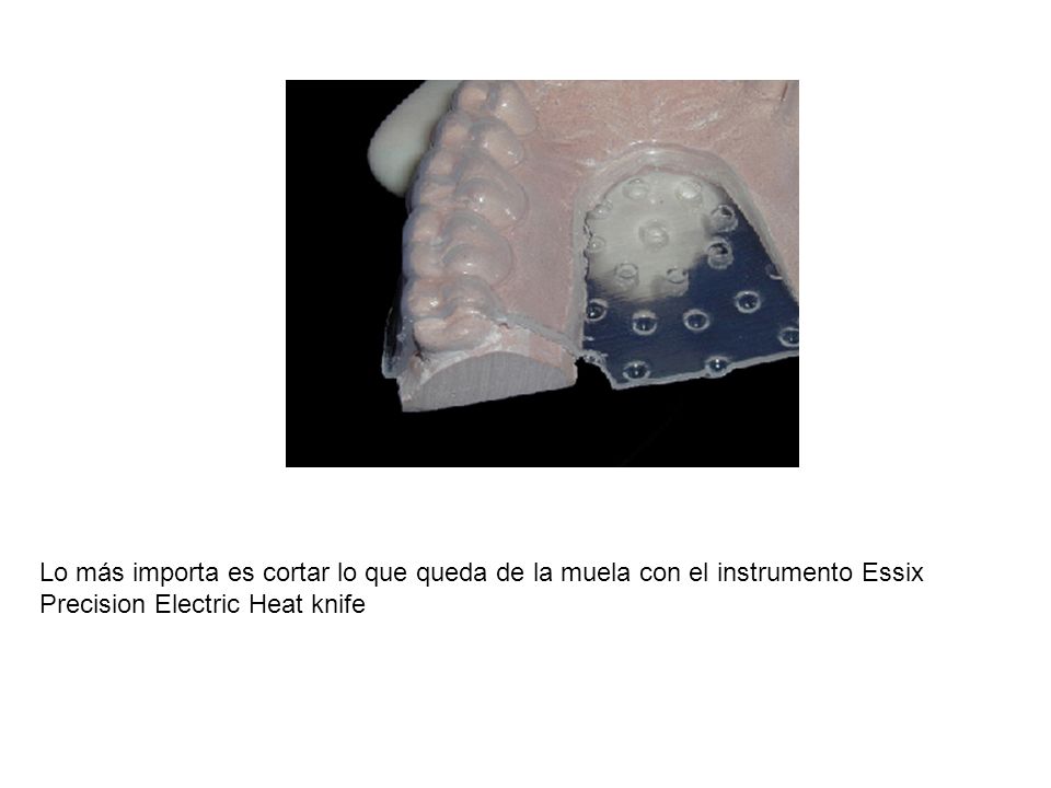 Lo más importa es cortar lo que queda de la muela con el instrumento Essix Precision Electric Heat knife