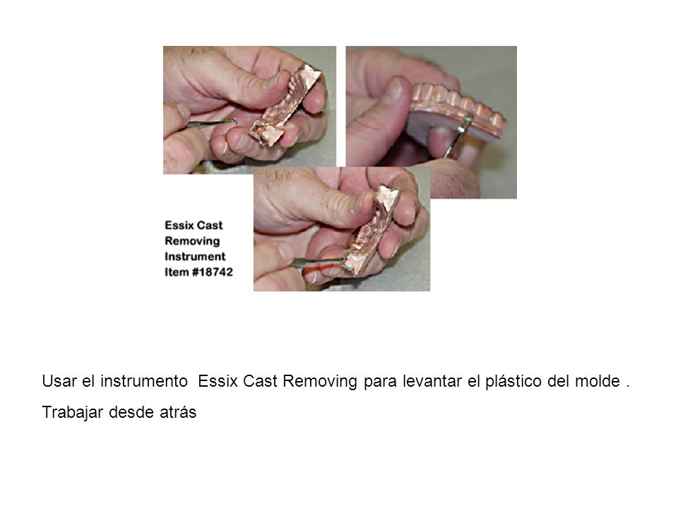Usar el instrumento Essix Cast Removing para levantar el plástico del molde .