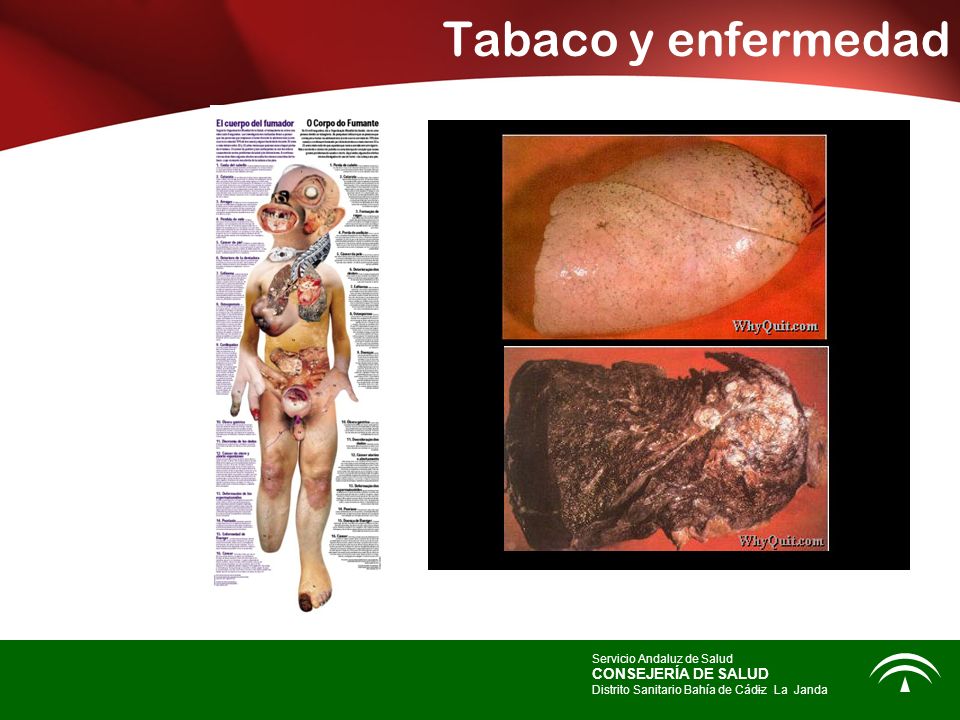 Tabaco y enfermedad CONSEJERÍA DE SALUD Servicio Andaluz de Salud