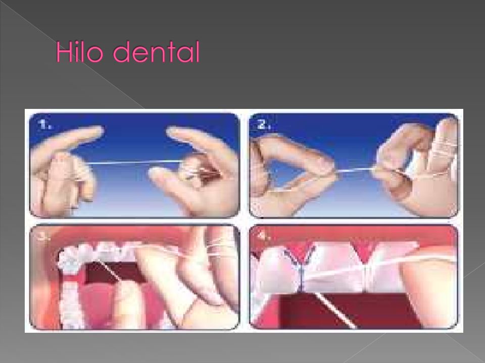 Hilo dental