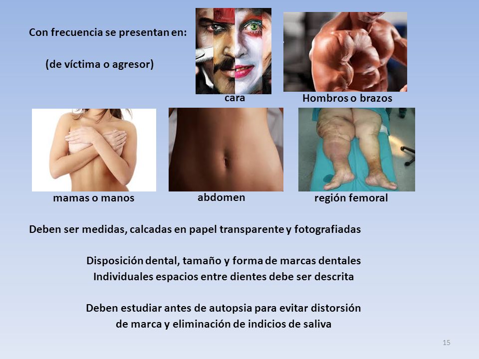Con frecuencia se presentan en: (de víctima o agresor) Deben ser medidas, calcadas en papel transparente y fotografiadas Disposición dental, tamaño y forma de marcas dentales Individuales espacios entre dientes debe ser descrita Deben estudiar antes de autopsia para evitar distorsión de marca y eliminación de indicios de saliva