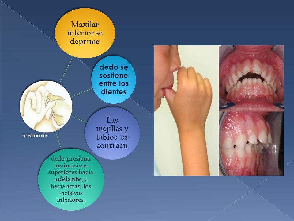 Maxilar inferior se deprime Las mejillas y labios se contraen