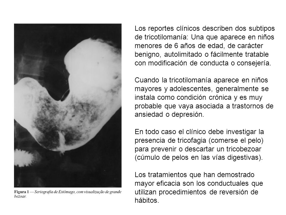 Los reportes clínicos describen dos subtipos de tricotilomanía: Una que aparece en niños menores de 6 años de edad, de carácter benigno, autolimitado o fácilmente tratable con modificación de conducta o consejería.