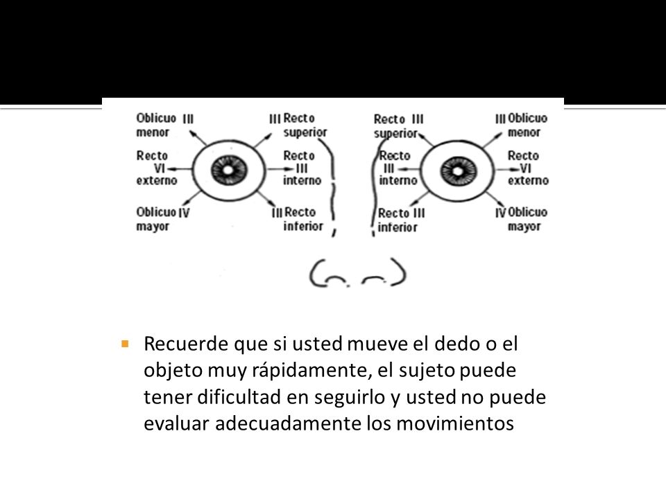 Recuerde que si usted mueve el dedo o el objeto muy rápidamente, el sujeto puede tener dificultad en seguirlo y usted no puede evaluar adecuadamente los movimientos