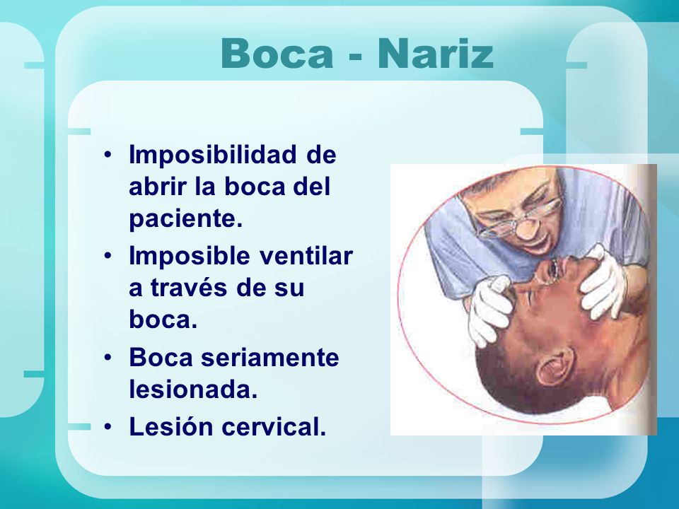 Boca - Nariz Imposibilidad de abrir la boca del paciente.