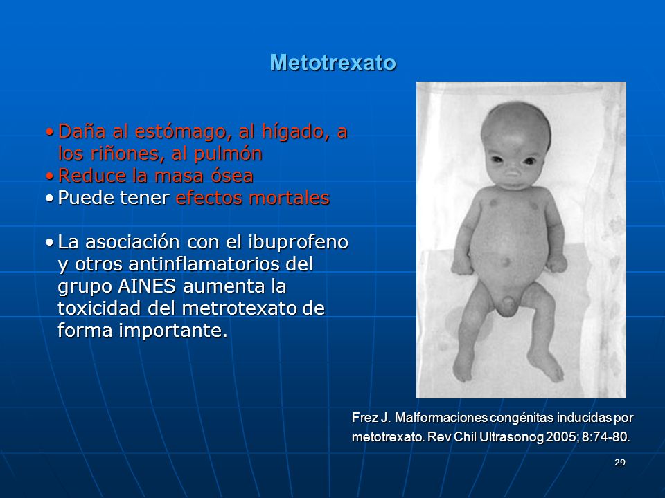 Metotrexato Daña al estómago, al hígado, a los riñones, al pulmón