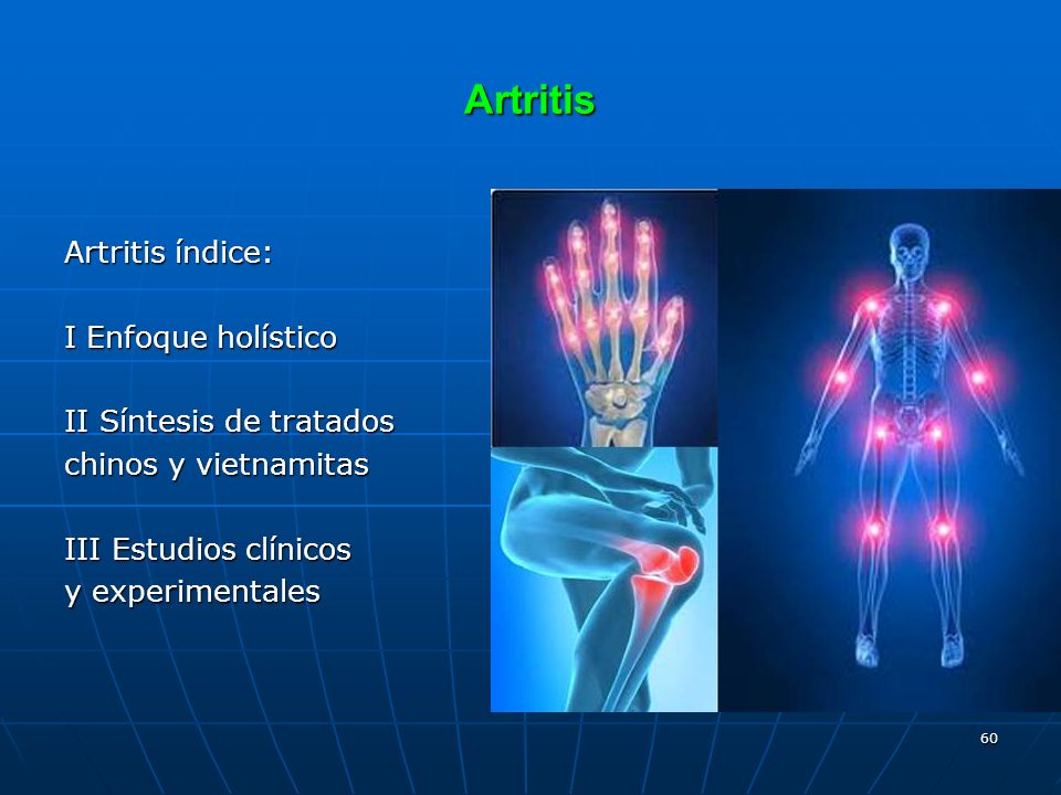 Artritis Artritis índice: I Enfoque holístico II Síntesis de tratados