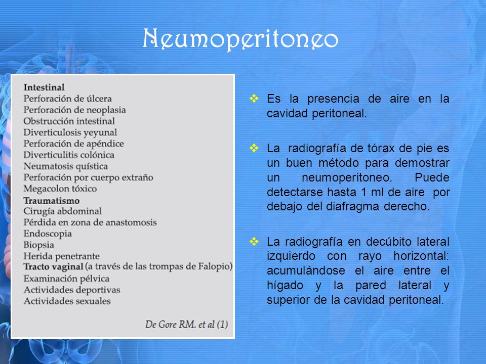 Neumoperitoneo Es la presencia de aire en la cavidad peritoneal.