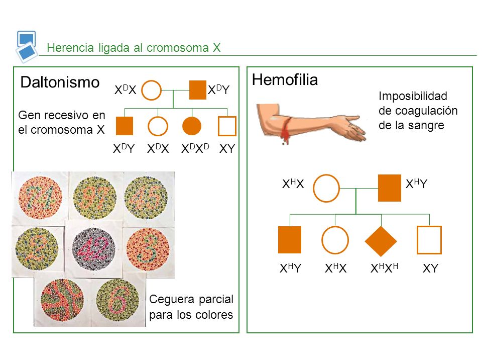 Hemofilia Daltonismo Herencia ligada al cromosoma X XDX XDY XDXD XY