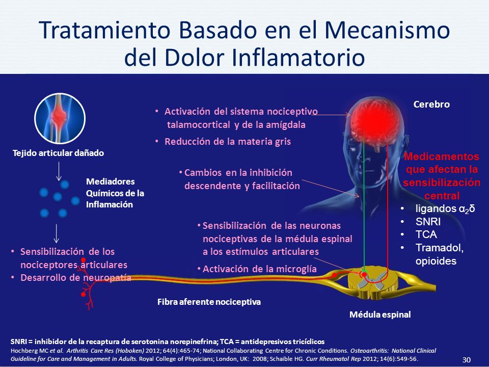 Tratamiento Basado en el Mecanismo del Dolor Inflamatorio
