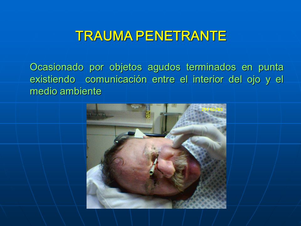 TRAUMA PENETRANTE Ocasionado por objetos agudos terminados en punta existiendo comunicación entre el interior del ojo y el medio ambiente.