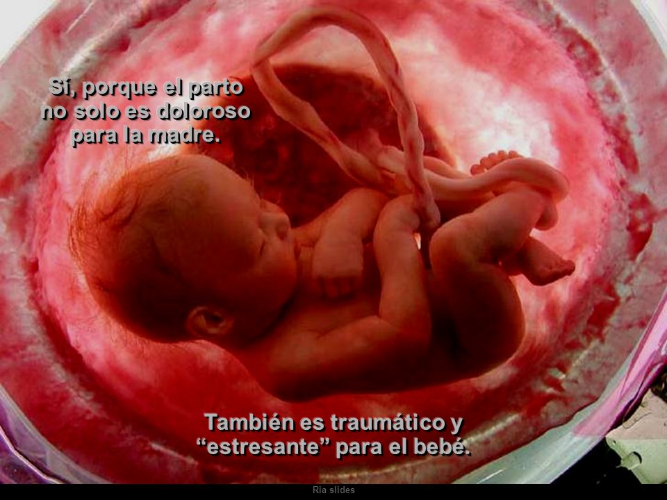 Sí, porque el parto no solo es doloroso para la madre.