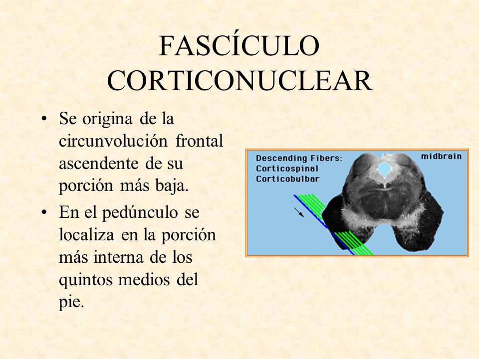 FASCÍCULO CORTICONUCLEAR
