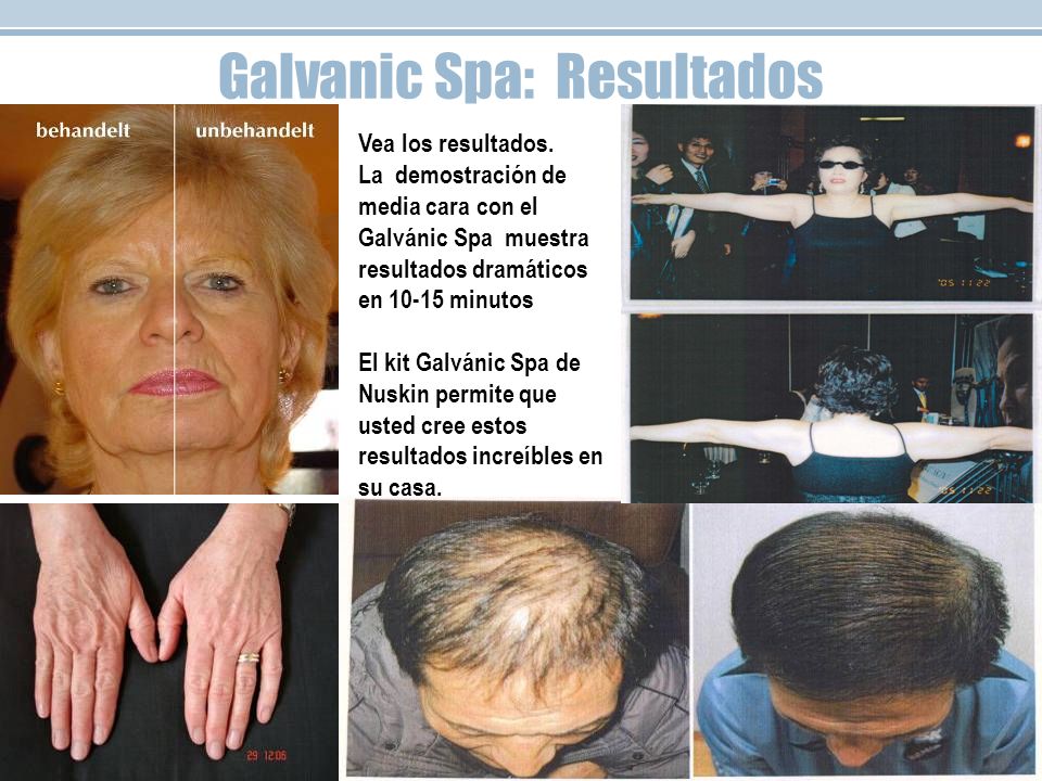 Galvanic Spa: Resultados