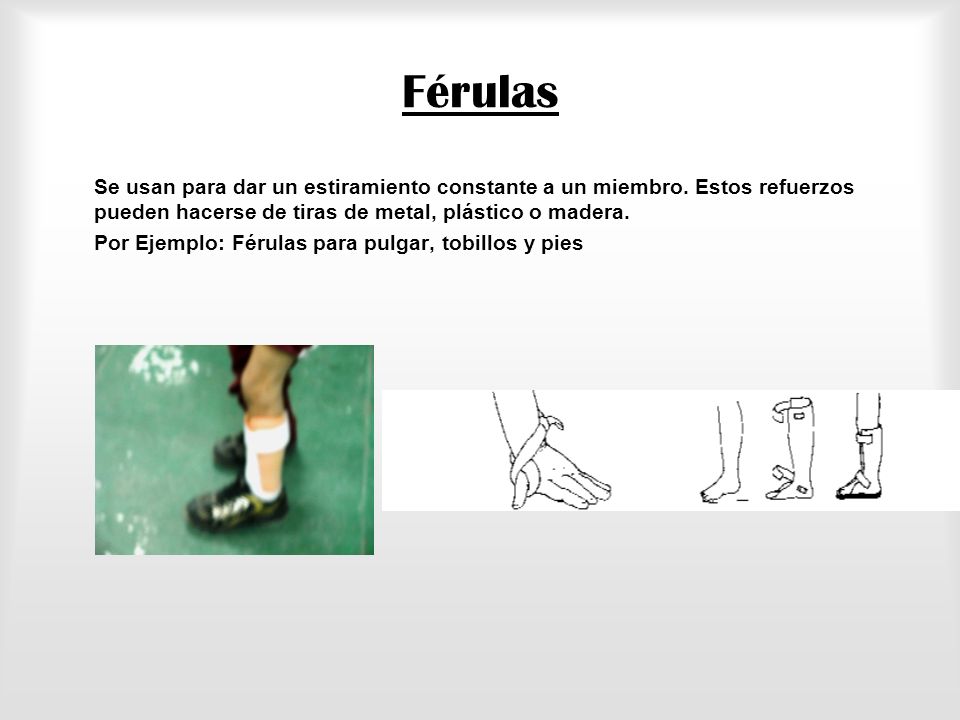 Férulas Se usan para dar un estiramiento constante a un miembro. Estos refuerzos pueden hacerse de tiras de metal, plástico o madera.