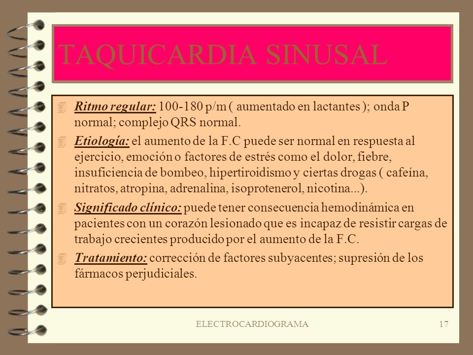 TAQUICARDIA SINUSAL Ritmo regular: p/m ( aumentado en lactantes ); onda P normal; complejo QRS normal.