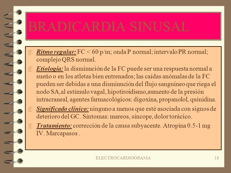BRADICARDIA SINUSAL Ritmo regular: FC < 60 p/m; onda P normal; intervalo PR normal; complejo QRS normal.