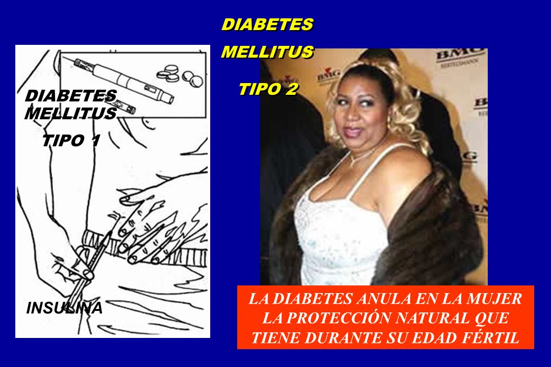 DIABETES MELLITUS TIPO 2. DIABETES MELLITUS. TIPO 1. LA DIABETES ANULA EN LA MUJER LA PROTECCIÓN NATURAL QUE TIENE DURANTE SU EDAD FÉRTIL.