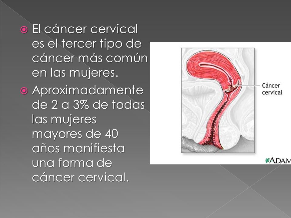 El cáncer cervical es el tercer tipo de cáncer más común en las mujeres.