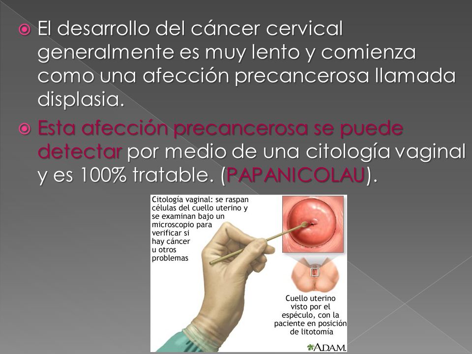 El desarrollo del cáncer cervical generalmente es muy lento y comienza como una afección precancerosa llamada displasia.